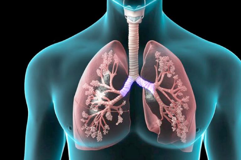 copd – acupuncture